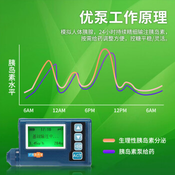 胰岛素泵(insulin pump)